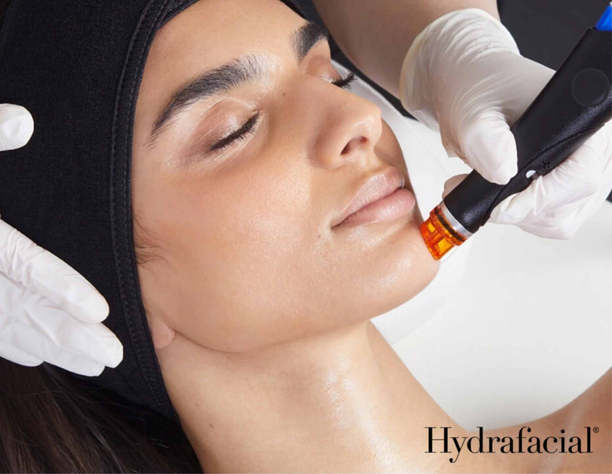 hydrafacial çözüm